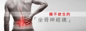 坐骨神經痛 sciatica