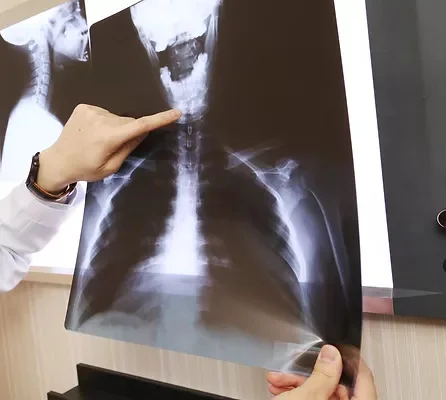 物理治療 X光影像診斷