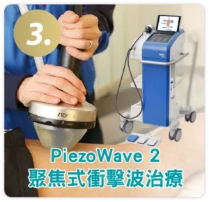 PiezoWave 2 聚焦式衝擊波治療