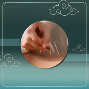 Acupuncture Therapy